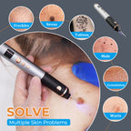 Close-up of freckle eraser - home beauty device - home beauty device