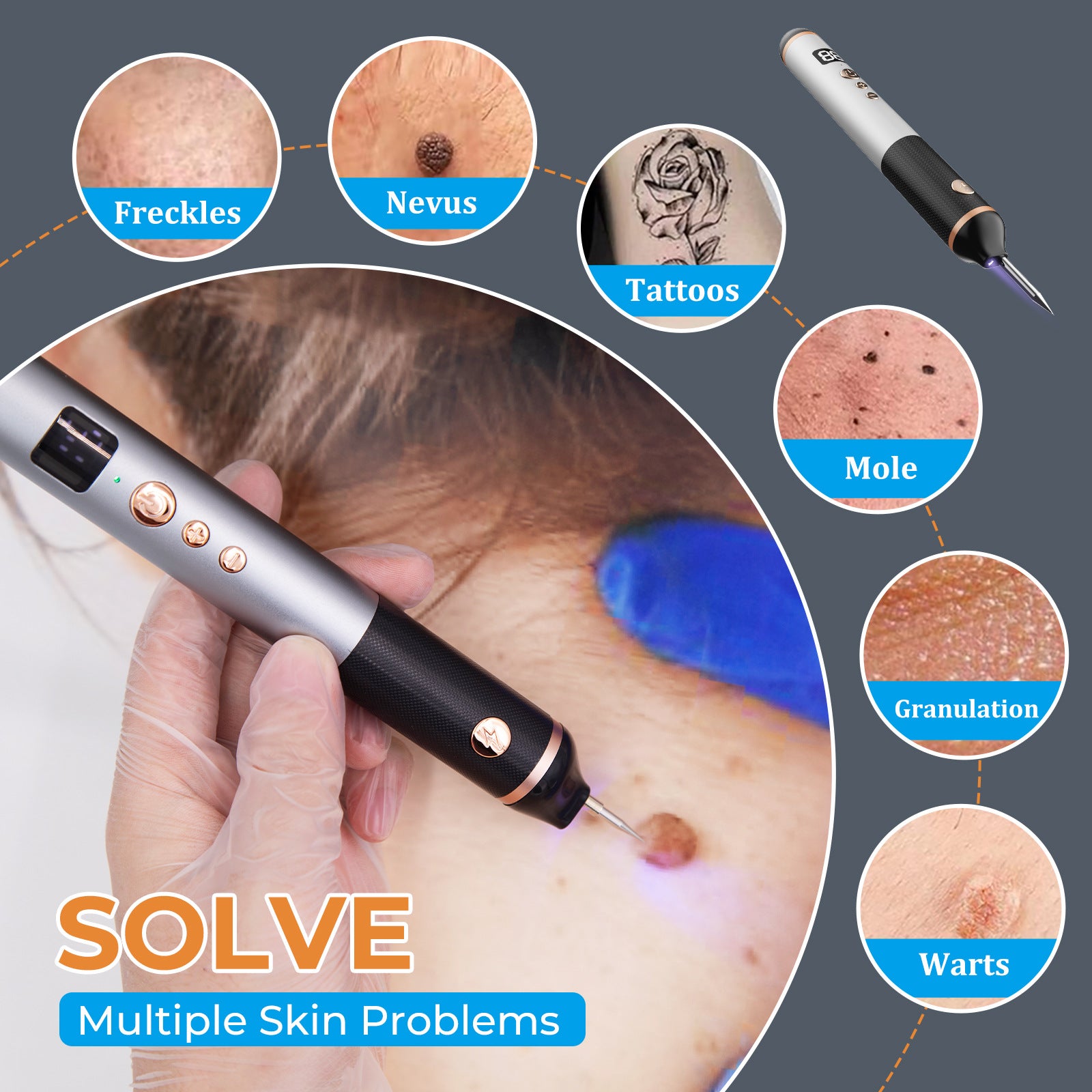 Close-up of freckle eraser - home beauty device - home beauty device