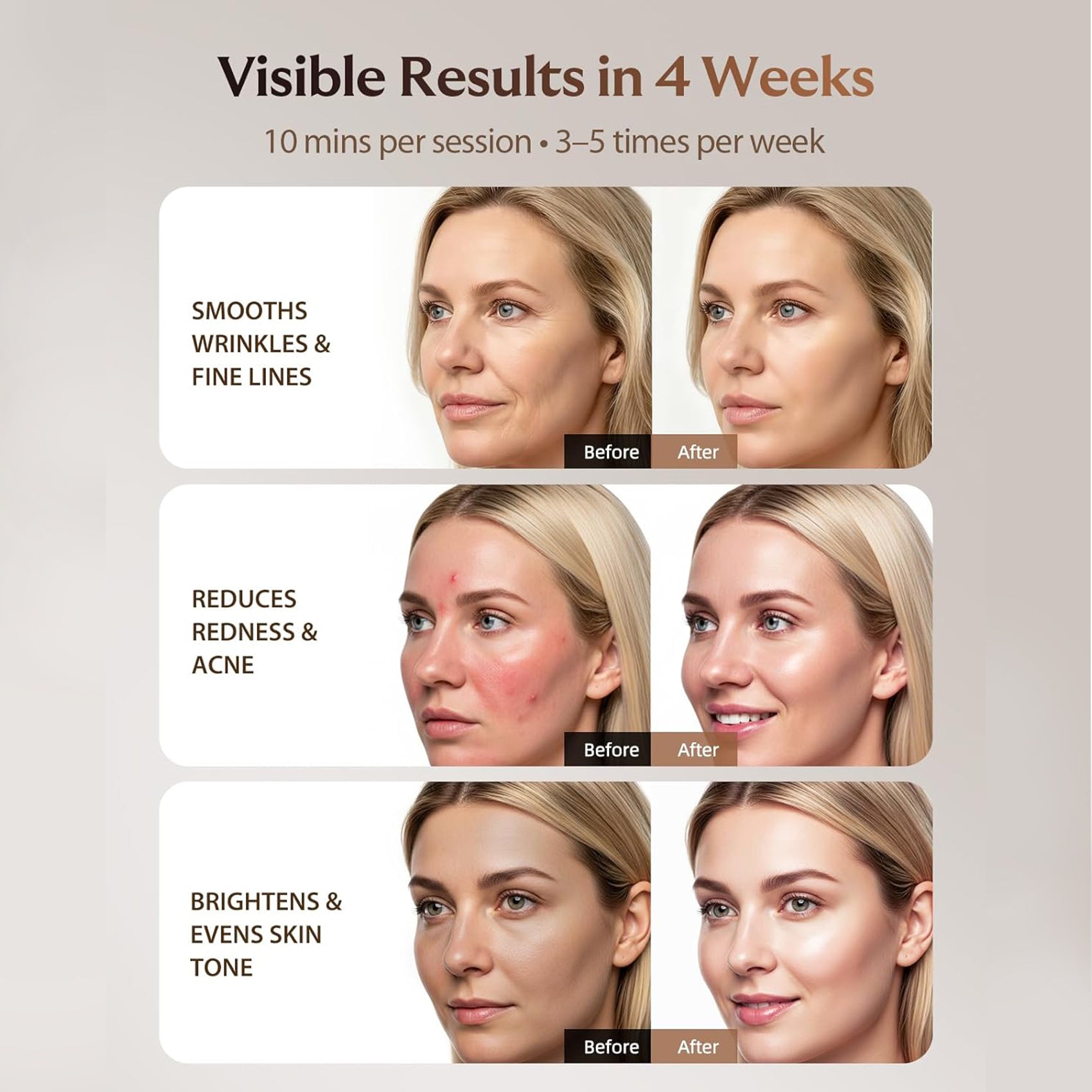 Using Professional 4-in-1 LED Face & Neck Mask Set - 480 High-Density LEDs with Deep-Penetrating NIR Therapy - LED Face Mask
